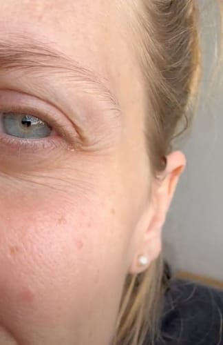 Customer photo review of Multi Collagen Superblend