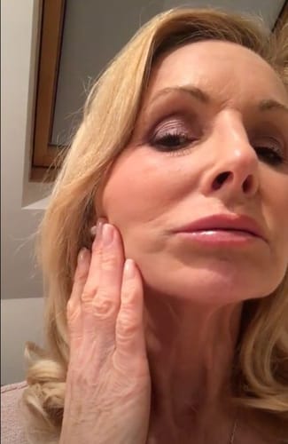 Customer photo review of Multi Collagen Superblend