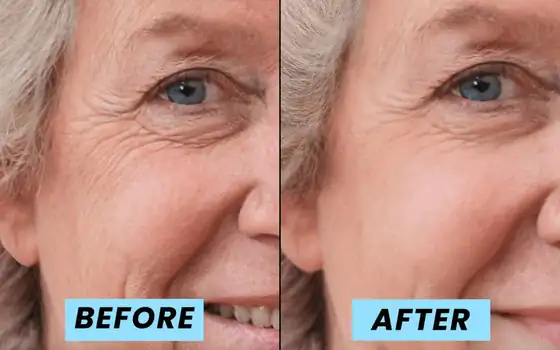 Victoria's before and after photos